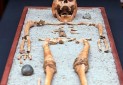 کشف تجهیزات پزشکی در گور رومی